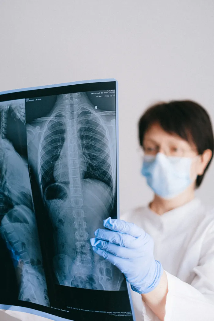 Doctor looking at an X-ray result